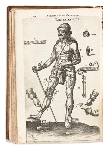 Scultetus, Johannes (1595-1645) Armamentarium Chirurgicum.